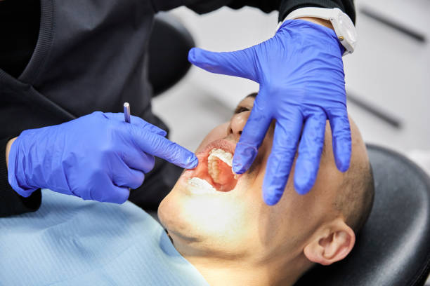 Best Emergency Denture Repair in Woodacre, CA