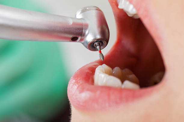 Best Urgent Dental Care for Toothaches in Woodacre, CA